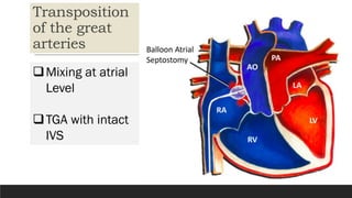 Fetal and Neonatal Circulation: Physiology, Transition, and Critical ...