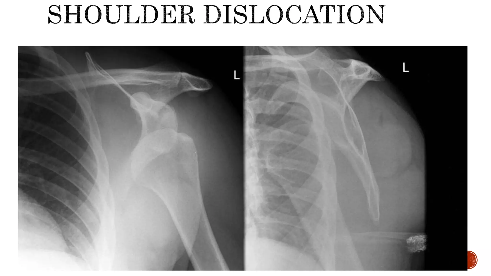 Kuliah Sport Injury X-Ray Alfian.pptx