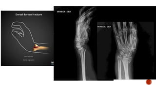 Kuliah Sport Injury X-Ray Alfian.pptx