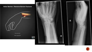 Kuliah Sport Injury X-Ray Alfian.pptx
