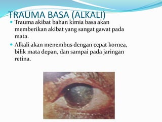 TRAUMA BASA (ALKALI)
 Trauma akibat bahan kimia basa akan
memberikan akibat yang sangat gawat pada
mata.
 Alkali akan menembus dengan cepat kornea,
bilik mata depan, dan sampai pada jaringan
retina.
 