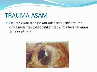TRAUMA ASAM
 Trauma asam merupakan salah satu jenis trauma
kimia mata yang disebabkan zat kimia bersifat asam
dengan pH < 7.
 