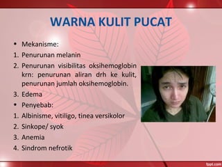WARNA KULIT PUCAT
• Mekanisme:
1. Penurunan melanin
2. Penurunan visibilitas oksihemoglobin
krn: penurunan aliran drh ke kulit,
penurunan jumlah oksihemoglobin.
3. Edema
• Penyebab:
1. Albinisme, vitiligo, tinea versikolor
2. Sinkope/ syok
3. Anemia
4. Sindrom nefrotik
 