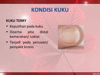 KONDISI KUKU
KUKU TERRY
• Keputihan pada kuku
• Disertai pita distal
kemerahan/ coklat
• Terjadi pada penuaan/
penyakit kronis
 
