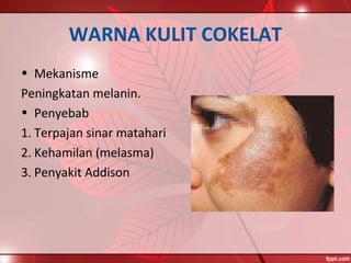 WARNA KULIT COKELAT
• Mekanisme
Peningkatan melanin.
• Penyebab
1. Terpajan sinar matahari
2. Kehamilan (melasma)
3. Penyakit Addison
 