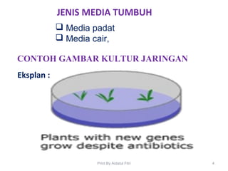 CONTOH GAMBAR KULTUR JARINGAN
Eksplan :
JENIS MEDIA TUMBUH
 Media padat
 Media cair,
4Print By Aidatul Fitri
 