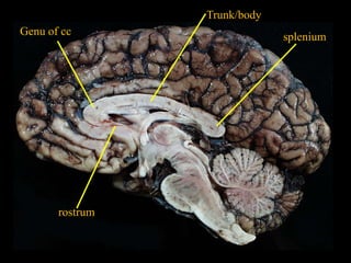Trunk/body
Genu of cc                    splenium




       rostrum
 