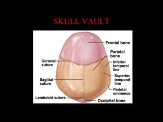 SKULL VAULT
 
