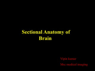 Sectional Anatomy of
       Brain


                Vipin kumar
                Msc medical imaging
 
