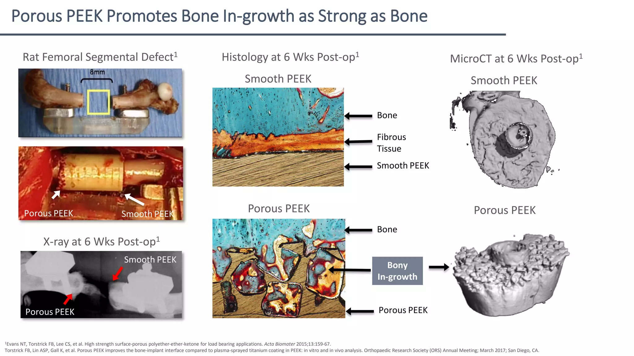 Spine Implants: Porous Coatings vs. Porous Materials vs. Additive ...