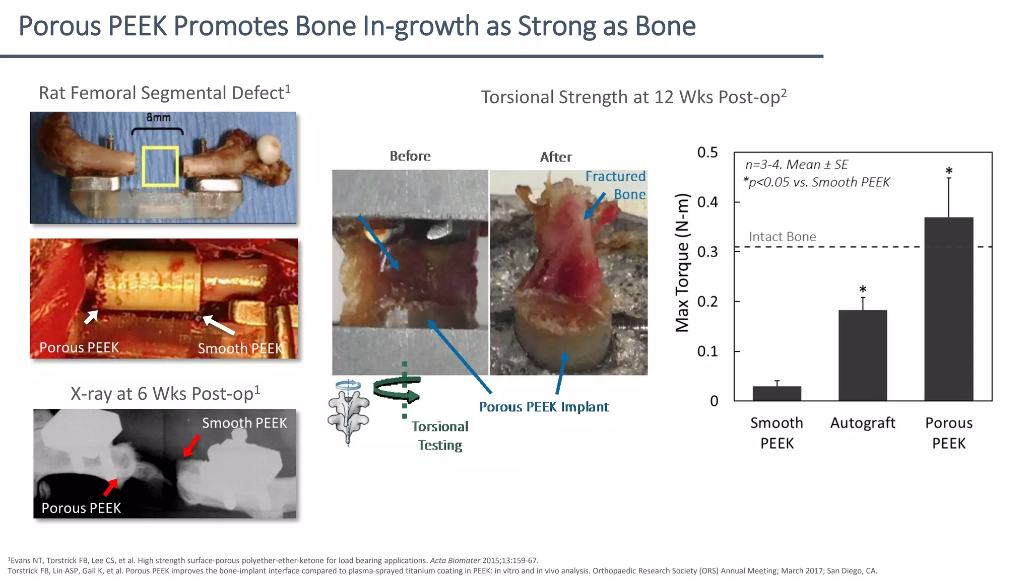 Spine Implants: Porous Coatings vs. Porous Materials vs. Additive ...