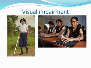 Visual impairment
 