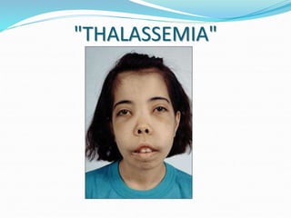 "THALASSEMIA"
 