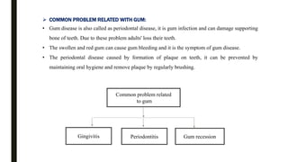  COMMON PROBLEM RELATED WITH GUM:
• Gum disease is also called as periodontal disease, it is gum infection and can damage supporting
bone of teeth. Due to these problem adults' loss their teeth.
• The swollen and red gum can cause gum bleeding and it is the symptom of gum disease.
• The periodontal disease caused by formation of plaque on teeth, it can be prevented by
maintaining oral hygiene and remove plaque by regularly brushing.
Common problem related
to gum
Gingivitis Periodontitis Gum recession
 