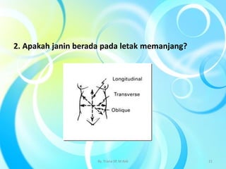 2. Apakah janin berada pada letak memanjang?
By. Triana SP, M.Keb 21
 