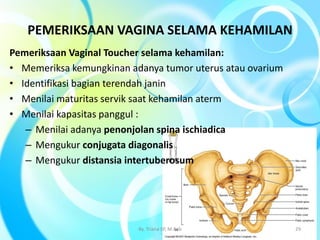 Pemeriksaan Vaginal Toucher selama kehamilan:
• Memeriksa kemungkinan adanya tumor uterus atau ovarium
• Identifikasi bagian terendah janin
• Menilai maturitas servik saat kehamilan aterm
• Menilai kapasitas panggul :
– Menilai adanya penonjolan spina ischiadica
– Mengukur conjugata diagonalis
– Mengukur distansia intertuberosum
PEMERIKSAAN VAGINA SELAMA KEHAMILAN
By. Triana SP, M.Keb 29
 