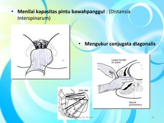 • Menilai kapasitas pintu bawahpanggul : (Distansia
Interspinarum)
• Mengukur conjugata diagonalis
By. Triana SP, M.Keb 30
 