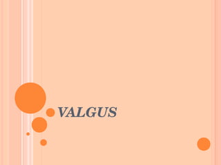 VALGUS 