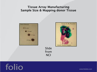 Tissue Microarray presentation | KEY