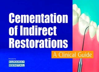 Cementation
of Indirect
Restorations
A Clinical GuidePresented by
 