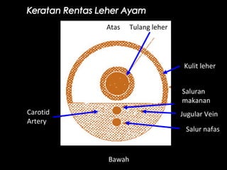 Tulang leherAtas
Carotid
Artery
Kulit leher
Saluran
makanan
Jugular Vein
Salur nafas
Bawah
 