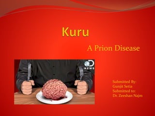 A Prion Disease
Submitted By:
Gunjit Setia
Submitted to:
Dr. Zeeshan Najm
 