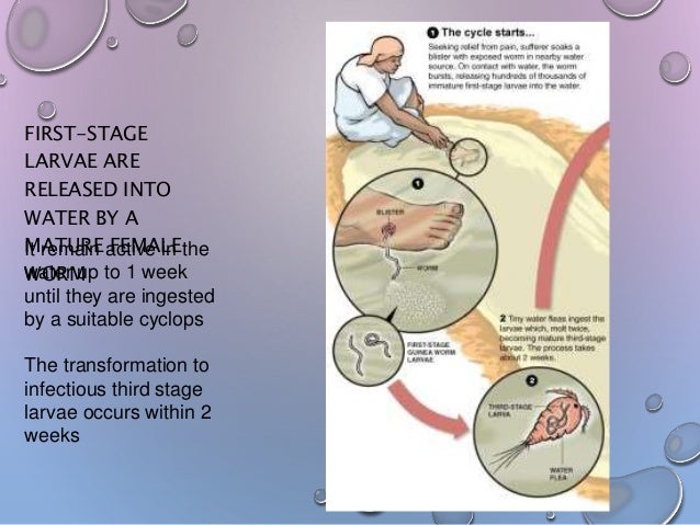 Dracunculus medinensis Guinea Worm