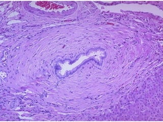 Autoimmune Liver Disease - Kuwait | PPT