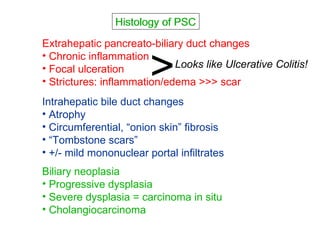 Autoimmune Liver Disease - Kuwait | PPT