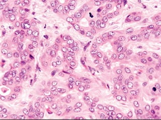 Autoimmune Liver Disease - Kuwait | PPT