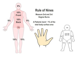 Comprehensive Overview of Burn Injuries: Classification, Symptoms, and ...
