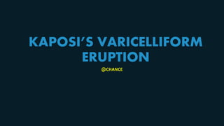 KAPOSI’S VARICELLIFORM
ERUPTION
@CHANCE
 