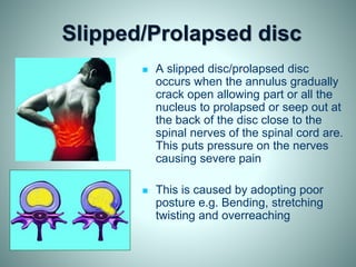 Slipped/Prolapsed disc
 A slipped disc/prolapsed disc
occurs when the annulus gradually
crack open allowing part or all the
nucleus to prolapsed or seep out at
the back of the disc close to the
spinal nerves of the spinal cord are.
This puts pressure on the nerves
causing severe pain
 This is caused by adopting poor
posture e.g. Bending, stretching
twisting and overreaching
 
