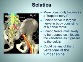 Sciatica
 More commonly known as
a “trapped nerve”
 Sciatic nerve is largest
nerve in body consisting
of 5 nerve roots.
 Sciatic Nerve most likely
to be trapped as it leaves
the vertebrae as it passes
to the pelvis
 Could be any of the 5
vertebrae of the
lumber spine
 