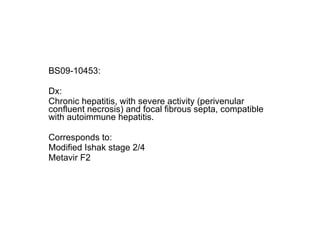 BS09-10453:  Dx: Chronic hepatitis, with severe activity (perivenular confluent necrosis) and focal fibrous septa, compatible with autoimmune hepatitis. Corresponds to: Modified Ishak stage 2/4 Metavir F2 