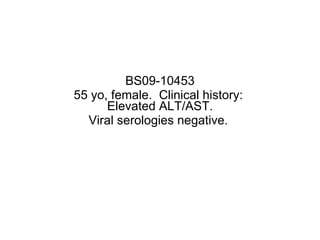 BS09-10453 55 yo, female.  Clinical history:  Elevated ALT/AST. Viral serologies negative.  