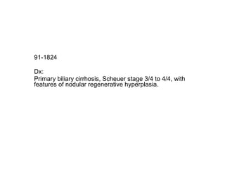 91-1824  Dx: Primary biliary cirrhosis, Scheuer stage 3/4 to 4/4, with features of nodular regenerative hyperplasia. 