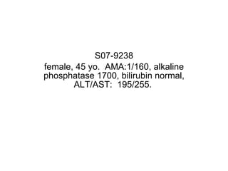 S07-9238 female, 45 yo.  AMA:1/160, alkaline phosphatase 1700, bilirubin normal, ALT/AST:  195/255.  