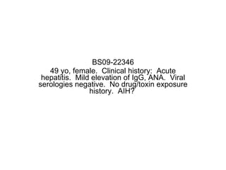 BS09-22346 49 yo, female.  Clinical history:  Acute hepatitis.  Mild elevation of IgG, ANA.  Viral serologies negative.  No drug/toxin exposure history.  AIH?  