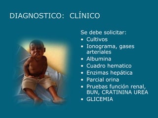 Kwashiorkor | PPTX