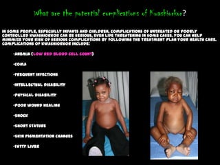 What are the potential complications of Kwashiorkor?
In some people, especially infants and children, complications of untreated or poorly
controlled kwashiorkor can be serious, even life threatening in some cases. You can help
minimize your risk of serious complications by following the treatment plan your health care.
Complications of kwashiorkor include:
•Anemia (low red blood cell count)
•Coma
•Frequent infections
•Intellectual disability
•Physical disability
•Poor wound healing
•Shock
•Short stature
•Skin pigmentation changes
•Fatty liver
 