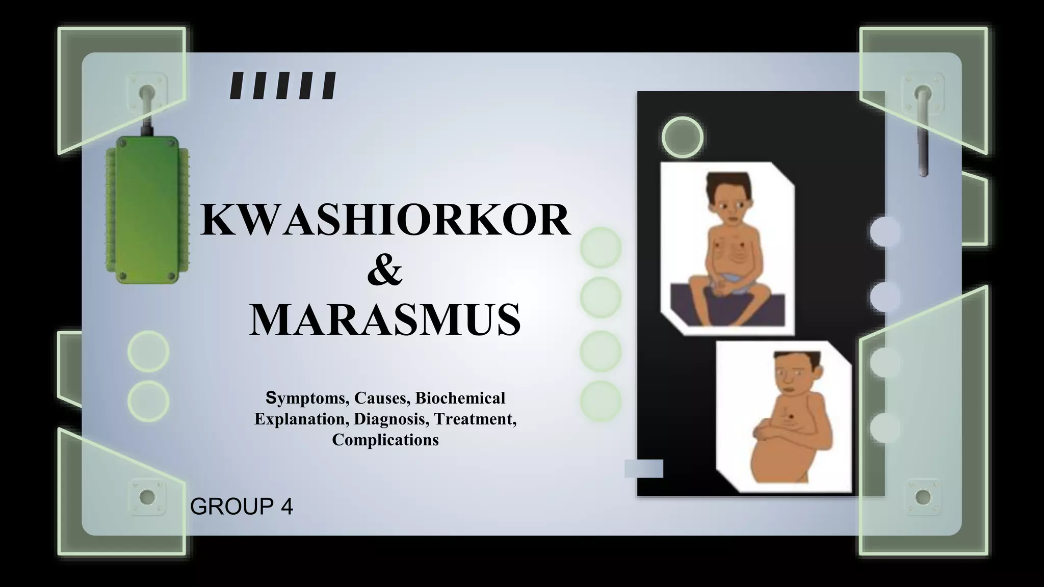 KWASHIORKORMARASMUSGROUP41.pptx