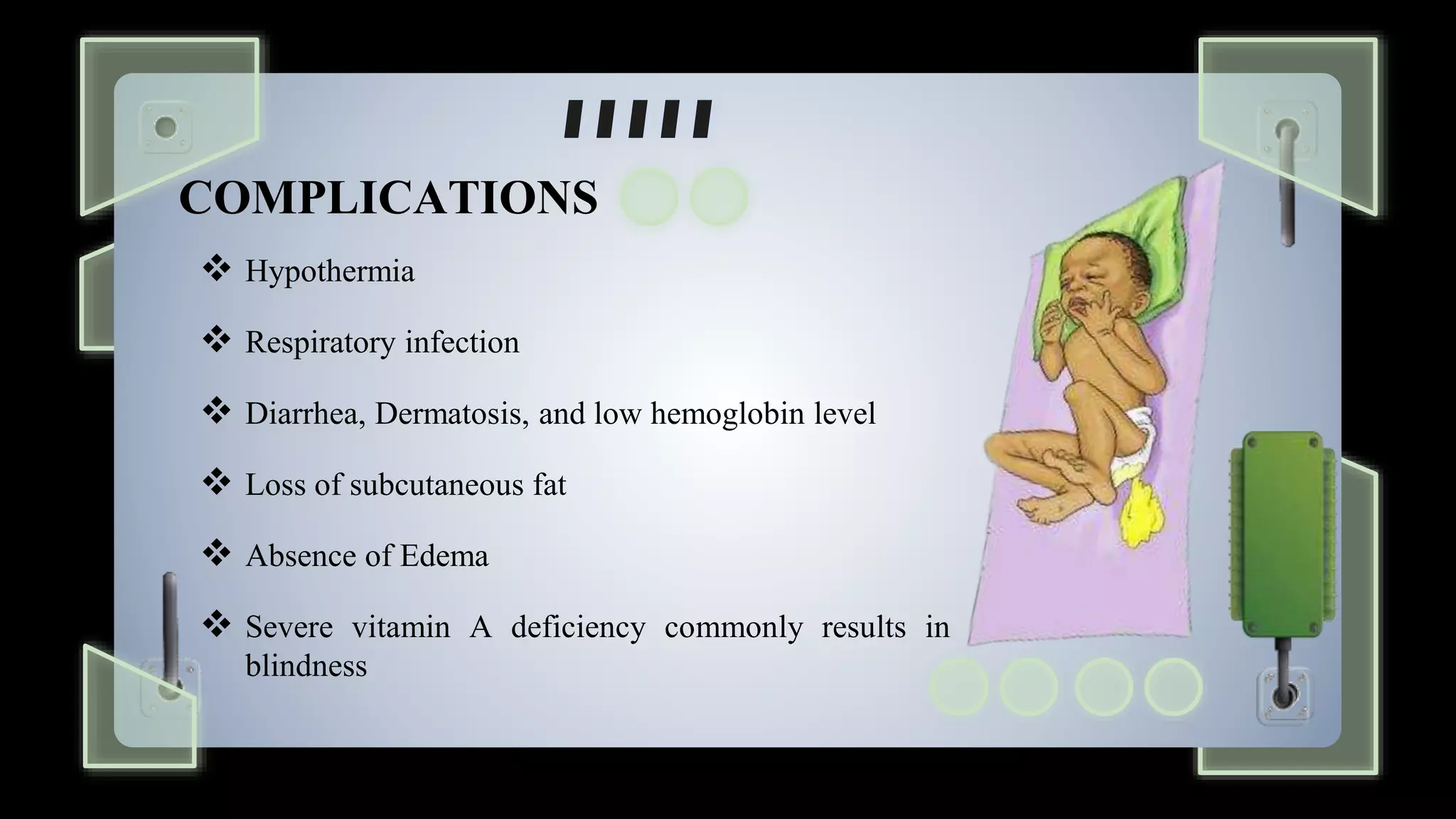 kwashiorkor-marasmus-group-4-1-pptx