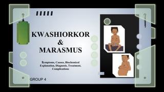 KWASHIORKOR
&
MARASMUS
Symptoms, Causes, Biochemical
Explanation, Diagnosis, Treatment,
Complications
GROUP 4
 