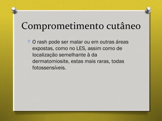 Comprometimento cutâneo
O O rash pode ser malar ou em outras áreas
expostas, como no LES, assim como de
localização semelhante à da
dermatomiosite, estas mais raras, todas
fotossensíveis.
 