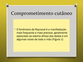 Comprometimento cutâneo
O O fenômeno de Raynaud é a manifestação
mais frequente e mais precoce, geralmente
associado ao edema difuso dos dedos e em
algumas vezes de toda a mão (Figura 1)
 