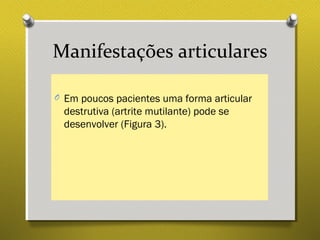 Manifestações articulares
O Em poucos pacientes uma forma articular
destrutiva (artrite mutilante) pode se
desenvolver (Figura 3).
 