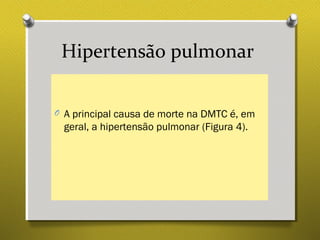 Hipertensão pulmonar
O A principal causa de morte na DMTC é, em
geral, a hipertensão pulmonar (Figura 4).
 