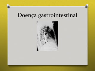 Doença gastrointestinal
 
