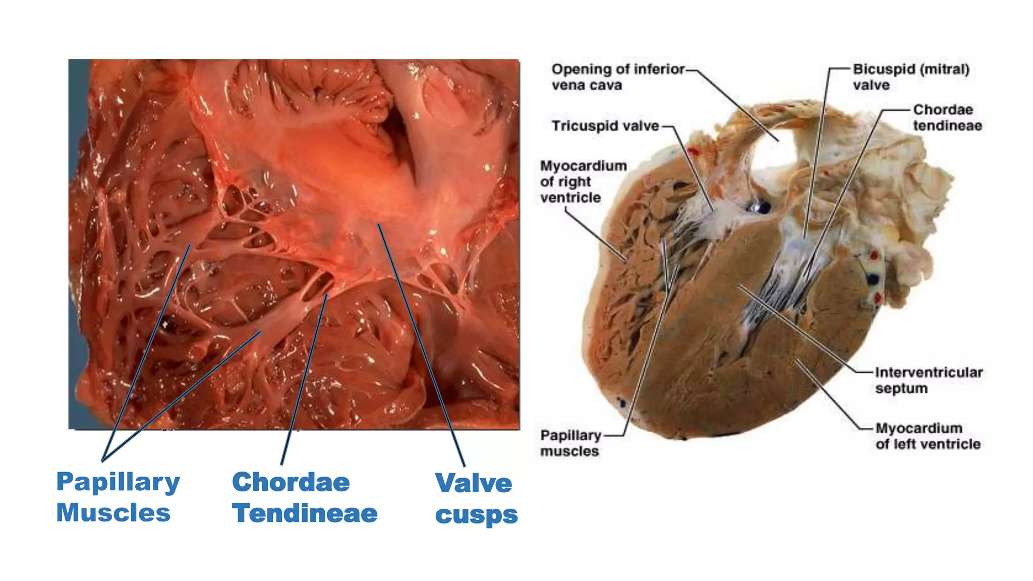 MiddlePapillary
Muscles
Chordae
Tendineae
Valve
cusps
 